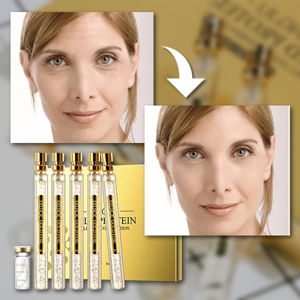 Set de sueros para el cuidado proteico de la piel | PROLIFT